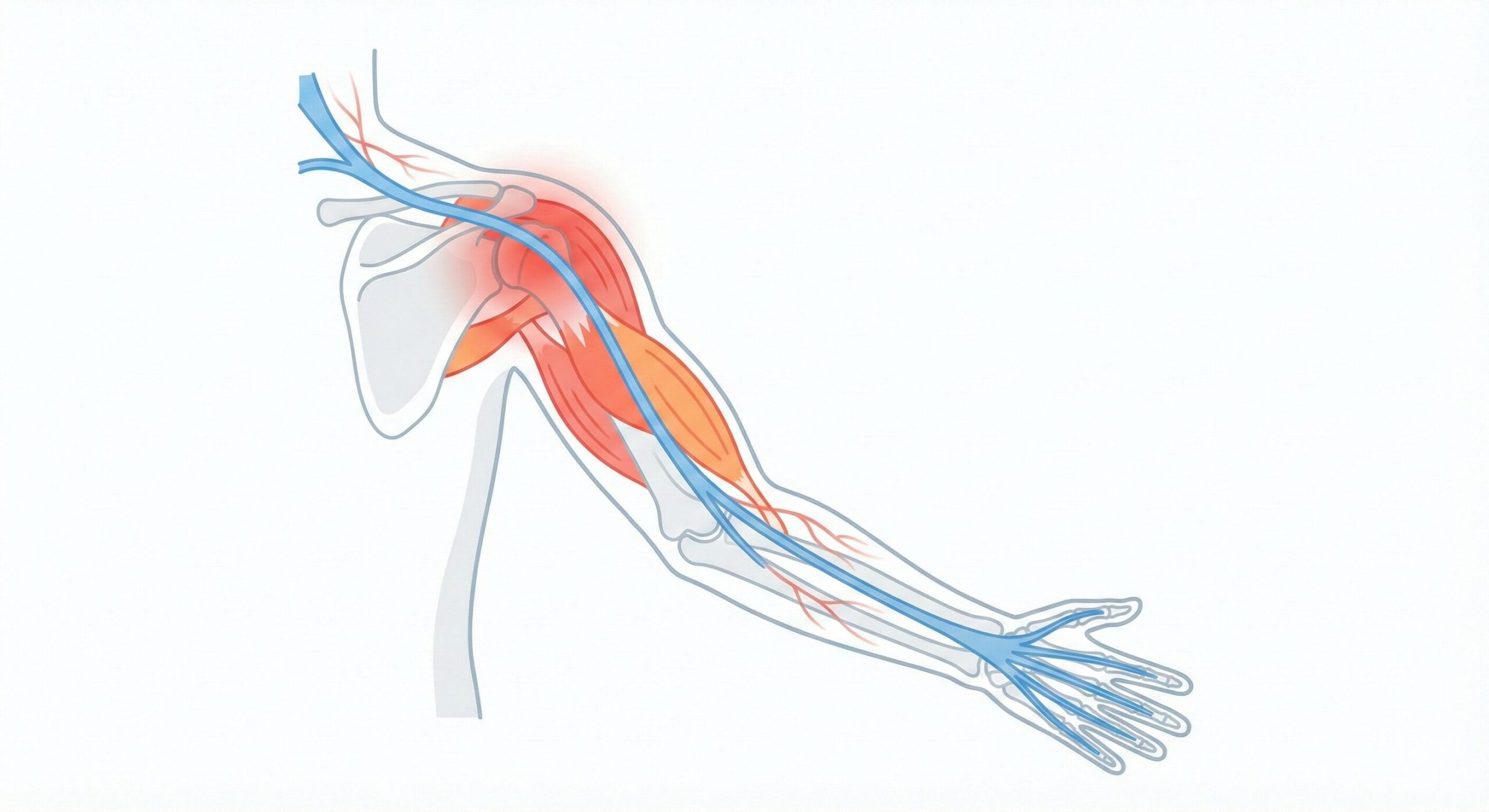 慢性的な肩こり解消の鍵は肩だけでなく腕・前腕まで整えること