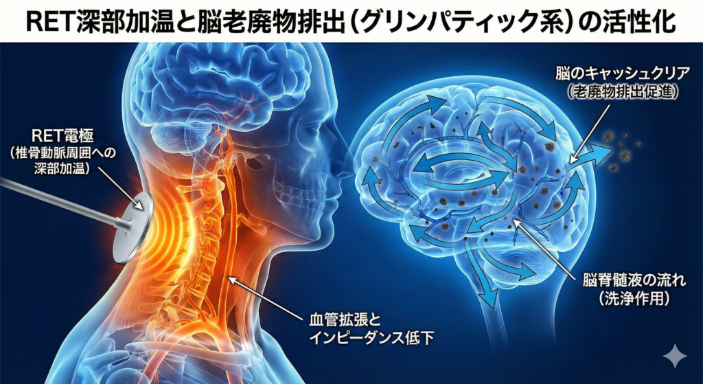 ラジオ波RET深部加温が脳脊髄液（グリンパティック系）の循環を促進し、脳疲労物質を排出するメカニズム図解